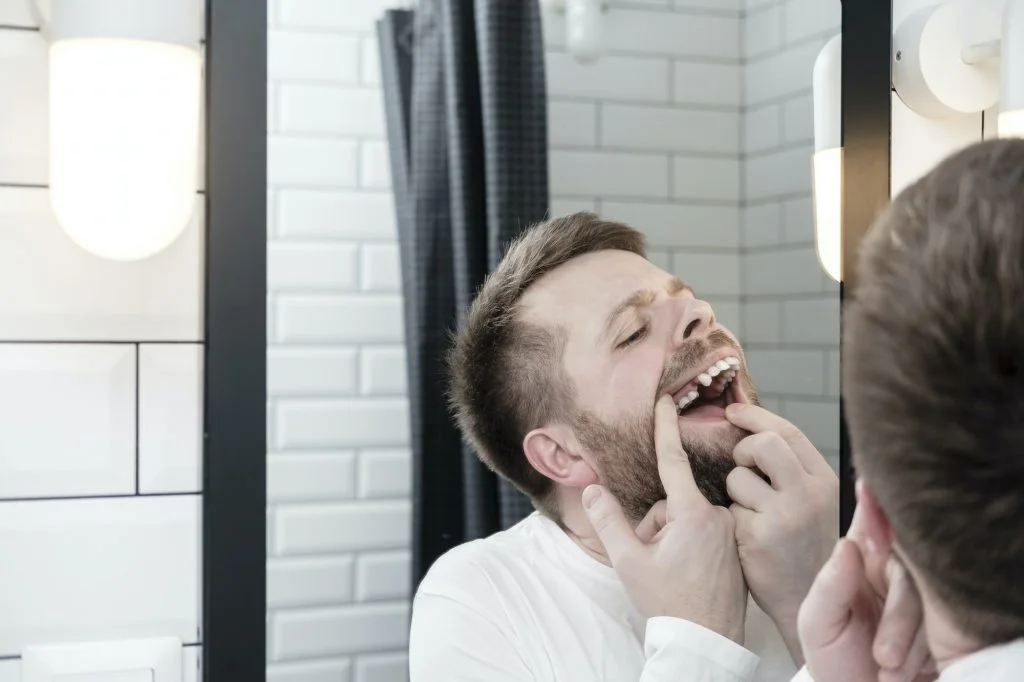 Upset young Caucasian man opened mouth and examines the absence of a tooth, looking in the mirror.